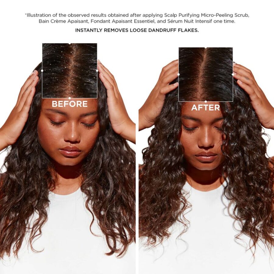 an image of a model with dandruff in their hair before symbiose scalp scrub use and after scalp scrub use.